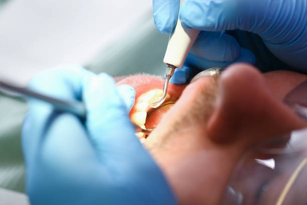 Best Weekend Emergency Dentist in James City, NC