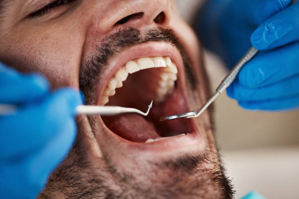 Best Emergency Broken Tooth Repair in James City, NC