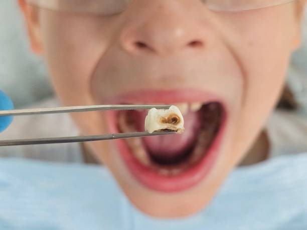 Best Emergency Root Canal Treatment in James City, NC