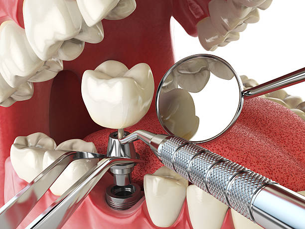 Best Pediatric Emergency Dentist in James City, NC